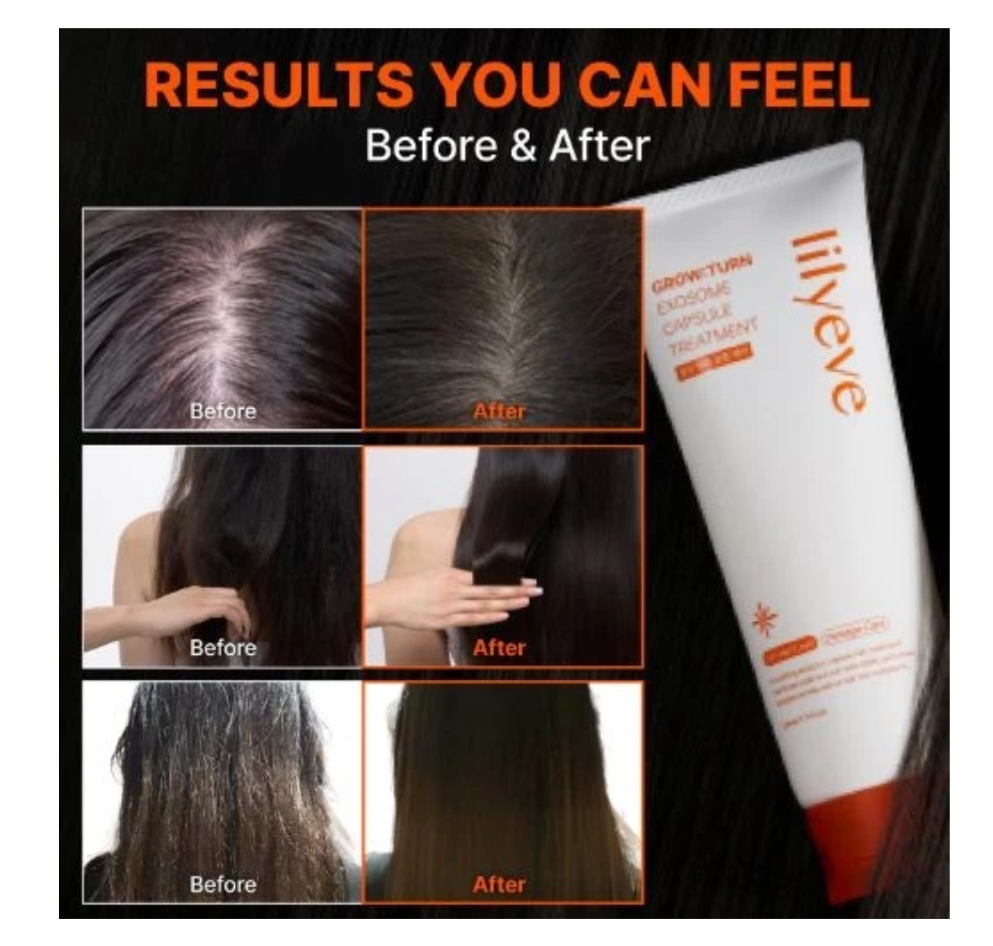 Lilyeve Anti-Hair Loss Repairing Exosome Essence Hair Mask